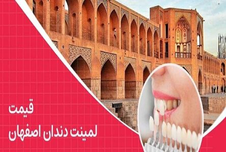 قیمت لمینت دندان در اصفهان