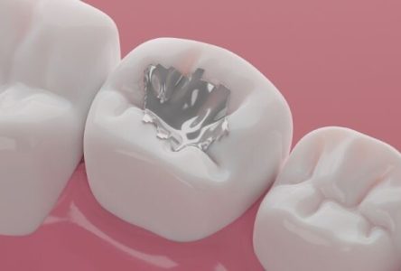 نکات اصلی هنگام خرید مواد دندانپزشکی برای دندانپزشکان