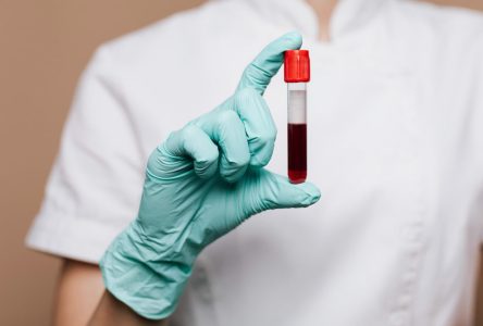 تفسیر جدول آزمایش خون همراه با توضیح علائم اختصاری در نتیجه آزمایش