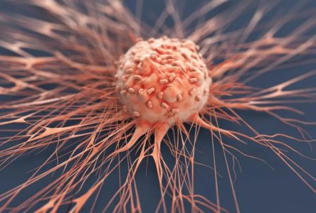 راهکار جدید محققان ایرانی برای درمان موثر تومورهای سرطانی