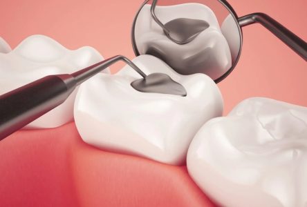 ساخت و ساز مایعی برای جلوگیری از پوسیدگی دندان